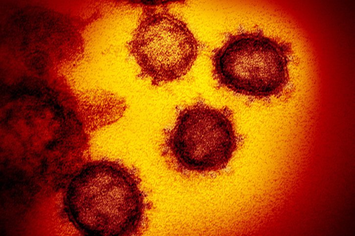 Le nouveau coronavirus a fait au moins 4'689'140 morts dans le monde depuis la fin décembre 2019, selon un bilan de l'AFP (archives). © KEYSTONE/EPA NATIONAL INSTITUTES OF HEALTH/NIAID- RML/NATIONAL INST