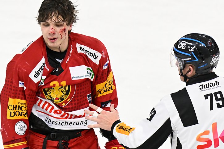 Bastian Guggenheim n'est pas sorti indemne de la bagarre. © KEYSTONE/MARCEL BIERI